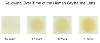 Human Crystalline Lens Over Time