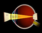 Cornea Focusing on Retina