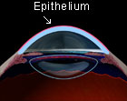 Epithelium Growing over Treated Area
